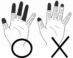 手指の全廃、欠損の基準図